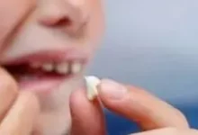 اسنان